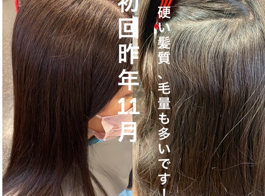 施術の流れてす！